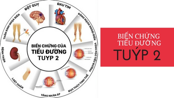 Biến chứng đái tháo đường tuýp 2