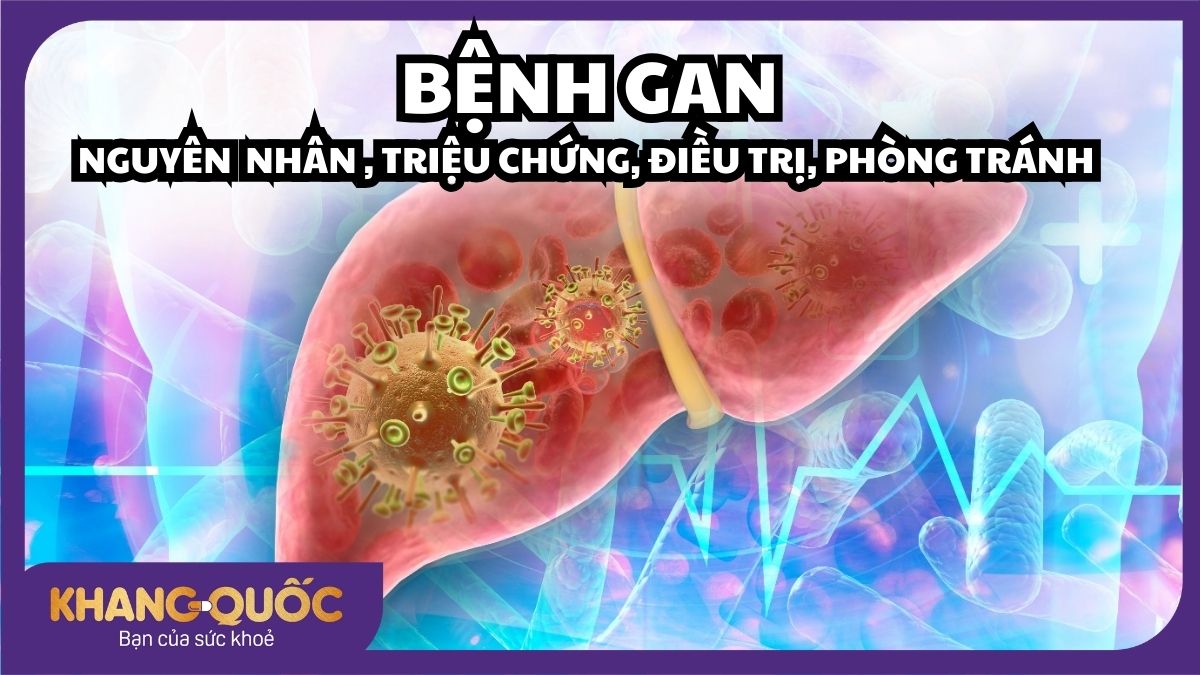 Bệnh gan: Nguyên nhân, triệu chứng, điều trị và cách phòng ngừa