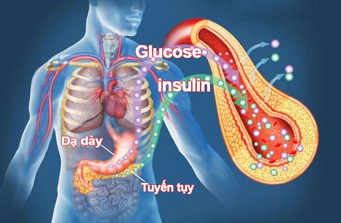 Rối loạn dung nạp glucose - Nguyên nhân gây đái tháo đường