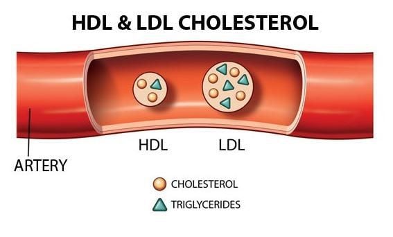 Người có lượng Triglycerides và Cholesterol không ổn định có nguy cơ mắc tiểu đường