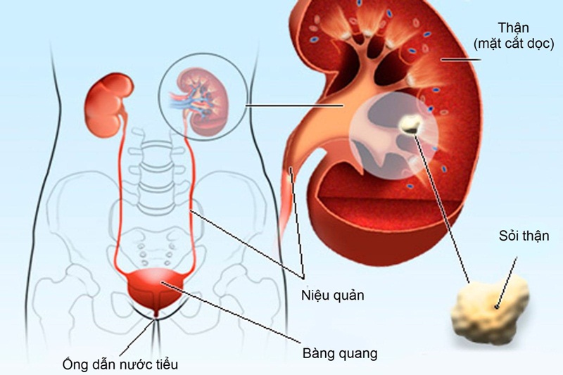 Thường xuyên đi tiểu