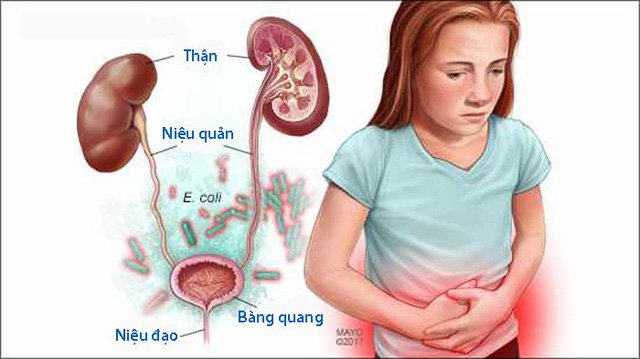 Tiểu đường thai kỳ gây biến chứng nhiễm khuẩn đường tiết niệu