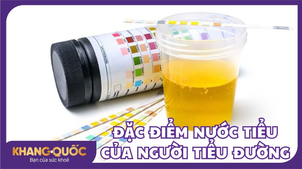 Nước tiểu của người tiểu đường có đặc điểm gì?