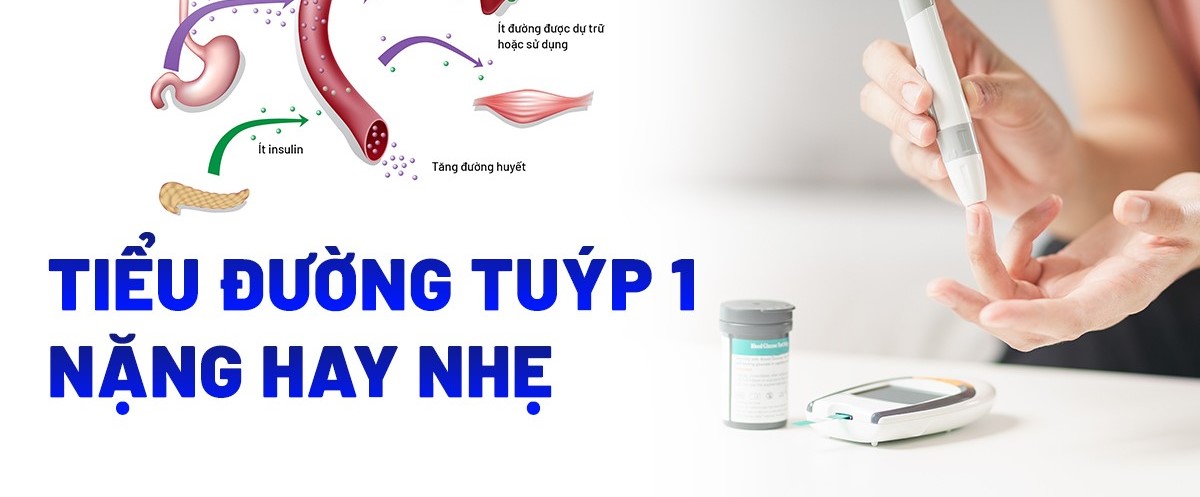 Đái tháo đường tuýp 1 là nặng hay nhẹ?