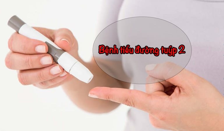 Chỉ số đường huyết tuýp 2