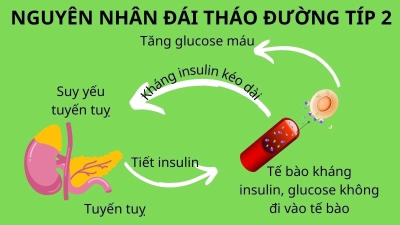 Nguyên nhân gây bệnh đái tháo đường tuýp 2