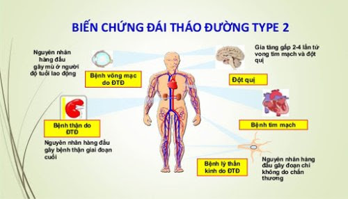 Tiểu đường tuýp 2 gây ra nhiều biến chứng