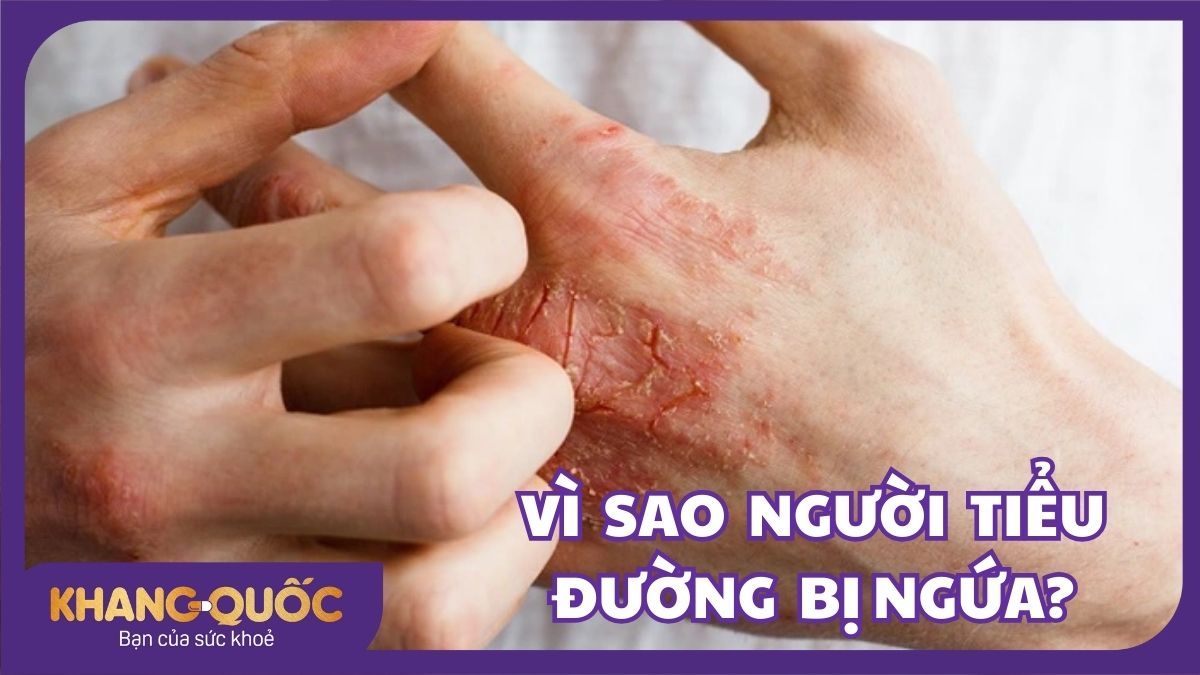 Vì sao người bị tiểu đường bị ngứa?