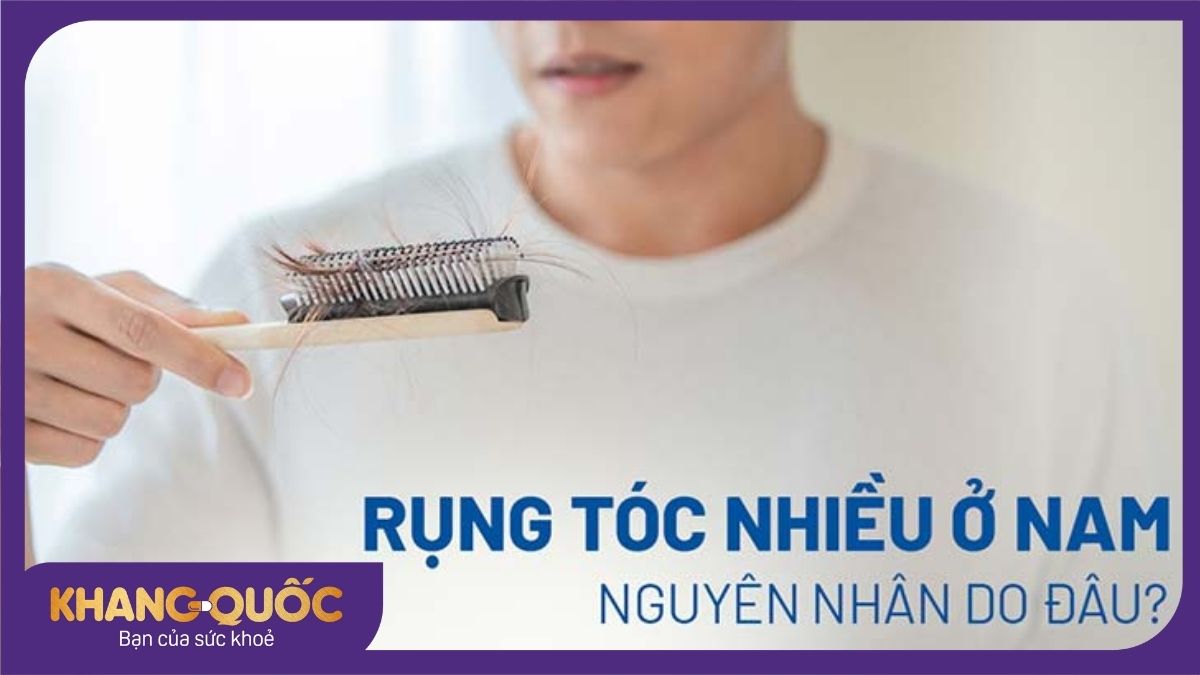 Nguyên nhân rụng tóc ở nam - Giải mã nỗi lo thấm kín