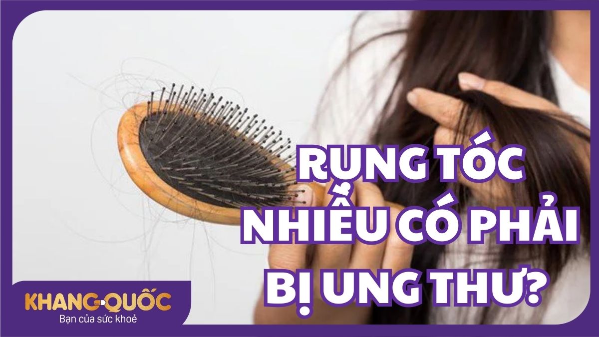 Giải đáp: Rụng tóc nhiều có phải bị ung thư không? 