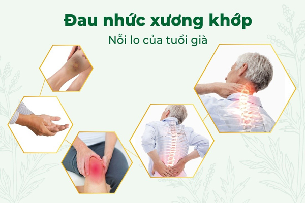 Bệnh xương nhức