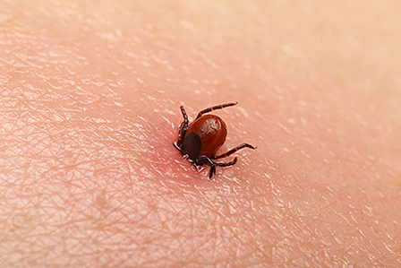 Bệnh Lyme do bọ ve chân đen gây đau khớp và cơ bắp