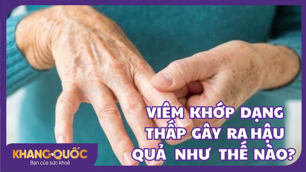 Viêm khớp dạng thấp gây ra hậu quả như thế nào?