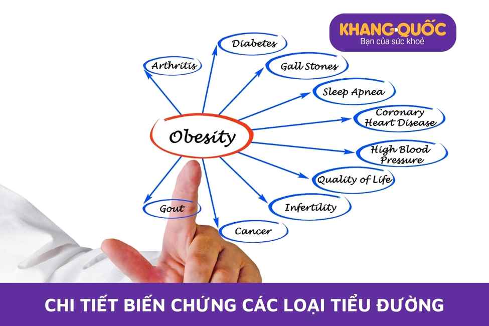 Chi tiết các biến chứng tiểu đường