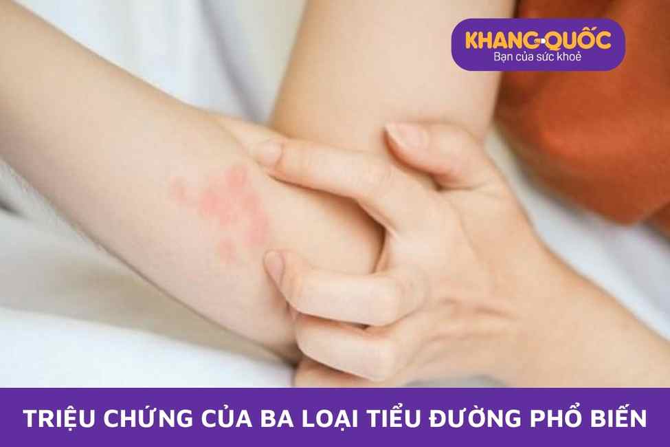 Triệu chứng của ba loại tiểu đường